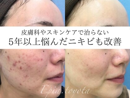エピア 豊田店(Epia)の写真