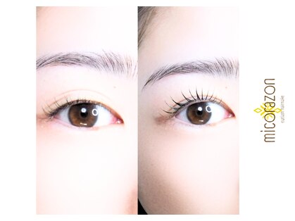 ミコラソン(micorazon)の写真