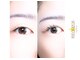 ミコラソン(micorazon)の写真