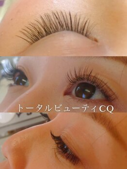 トータルビューティCQ/