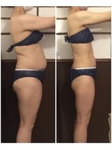 リアン(Liens)/フォースカッター痩身