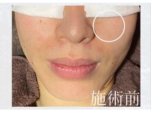 サロンドウルス(salon de ours)/大人気の光フェイシャル★