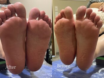 プラスジェイ 仙台長町店(plus J)/足の角質ケア 仙台/長町