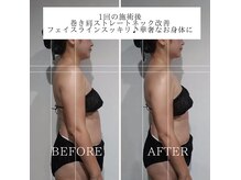 エクラリュクス アオヤマ(eclat Luxe AOYAMA)の雰囲気（1度でも首肩とっても楽に♪4.5回目の施術で更に見た目体重激変！）