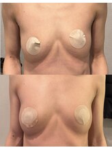 リレイスフクオカ(RelaceFUKUOKA)/施術3回目のお客様♪