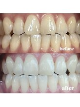 四国健康村 宇多津店/Before After