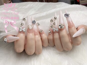 ナナネイル アメ村心斎橋店(NaNa Nail)の写真/【スカルプもOK◎】コンプレックス解消・自然な長さだしが可能♪爪のお悩み、お気軽にご相談下さい☆