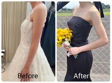 ヒーリングサロン ケリー(KELLY)/お客様ビフォーアフター