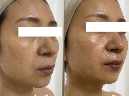 ブルーム(BLOOM)の写真