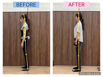 エクティブ整体院/20代女性/ビフォーアフター