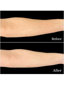 リブ(Lib)/薄着になる前に全身まるごとケア