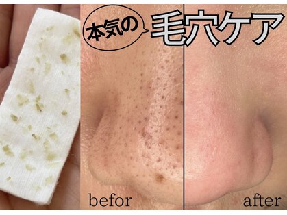 アモル(amor)の写真