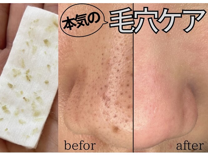 アモル(amor)｜ホットペッパービューティー