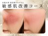 〈無針水光注入〉[お悩み別　肌改善プログラム]敏感肌改善コース
