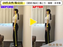 幸せのもり整体院/【20代女性/販売員】 Eさん