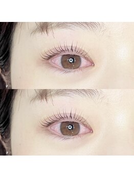 トゥービー(To Be)/カールリフト