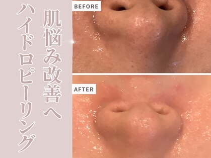 リソル(RISOL)の写真