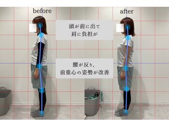 チューン(Tune)/30代 女性 月4回コース