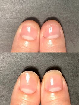 ブラン(blanc)の写真/大人女性に好評の〈美爪育成サロン〉特に40代以降の方から多く支持されていて口コミも高評価店◎