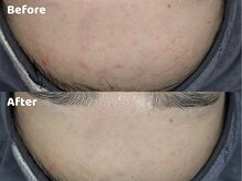 クリスタルビューティ 渋谷/NEW【XE'LHAセラピール】