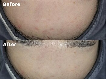 クリスタルビューティ 渋谷/NEW【XE'LHAセラピール】