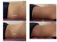 キララ(Kirara)の雰囲気（１回のビフォーアフター☆）