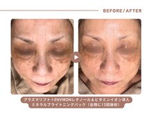 イエス マイサロン(yes My Salon)/ENVIRONトリートメント症例