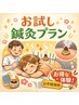 ☆シワやたるみ/リフトアップに☆初めての美容鍼お試しプラン¥3,980