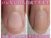 スターネイル(Starnail)/バレない自爪育成　