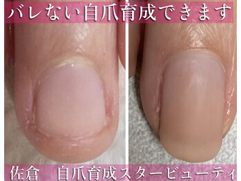 バレない自爪育成