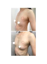 ルフルリール(Refleurir)/◆バストアップ症例/育乳◆