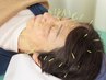 【頭痛改善】　頭＋首・肩鍼　施術時間45分　7,000円→6,300円