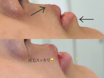 ジャスミン(JasMine)/フェイスワックス