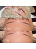 【お肌悩み別】うる艶肌リフトパック×脳疲労・眼精疲労リセットヘッドスパ