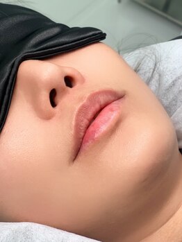 お肌をきれいにしたい