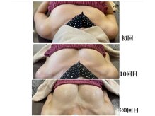 ロココ 四日市店(Rococo)/綺麗なおわん型