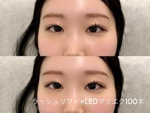 ニコ(Niko)/ラッシュリフト×LEDマツエク100