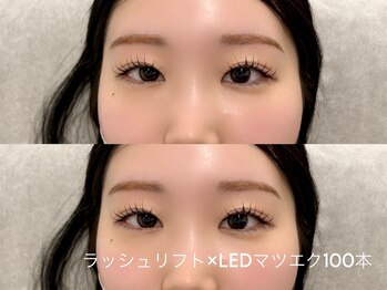 ニコ(Niko)/ラッシュリフト×LEDマツエク100