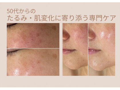 エクラ(eclat)の写真