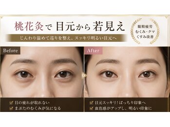 アモール 代々木(amor)の写真/目の奥の疲れにさよなら！むくみ改善、クマ・くすみケアで、ぱっちりクリアな瞳へ導きます◎