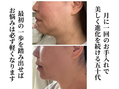ルウス(Ruusu)の写真