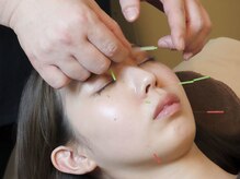 七彩鍼灸院/【鍼灸/美容鍼/恵比寿/代官山】