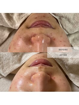 ウルス(ulus)/アンストレス