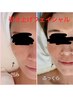 【たるみ改善/小顔/頬コケ】引き上げフェイシャル￥13200→￥8800