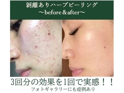 マ リールの写真