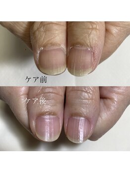 ハンドケア/ネイルケア