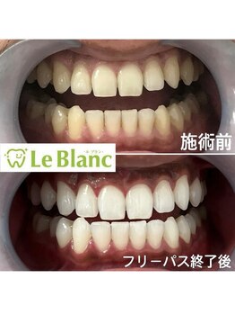 ルブラン 奈良店(Le Blanc)/白い歯で好印象を♪