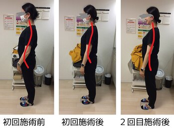 ストラボ 横浜店/ビフォーアフター４