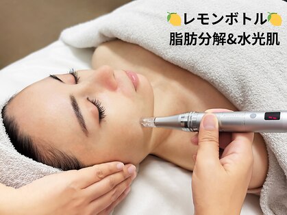 アオダモ(aodamo)の写真