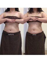 ジョワイユ(Joyeux)/腸の位置でお腹は変わる